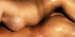 Profiel thumbnail